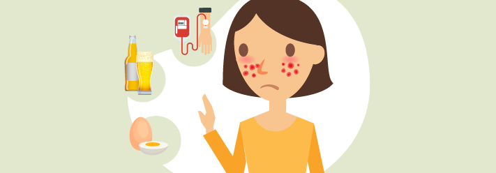 O que não posso fazer com urticaria